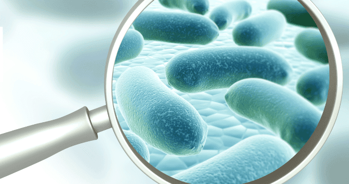 Legionella Bacteria - Aquachem